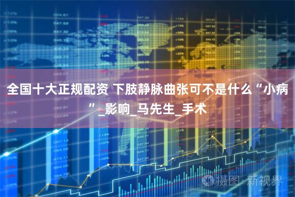 全国十大正规配资 下肢静脉曲张可不是什么“小病”_影响_马先生_手术
